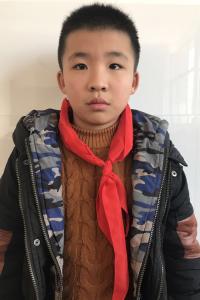 杨志强