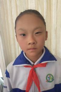 张政蓉
